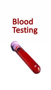 Dihydrotestosterone DHT Blood Test